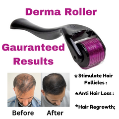 Derma Roller 540 Needles for Skin & Hair Therapy